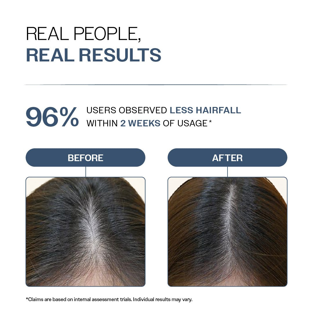 Hair Fall Control Shampoo with Peptides