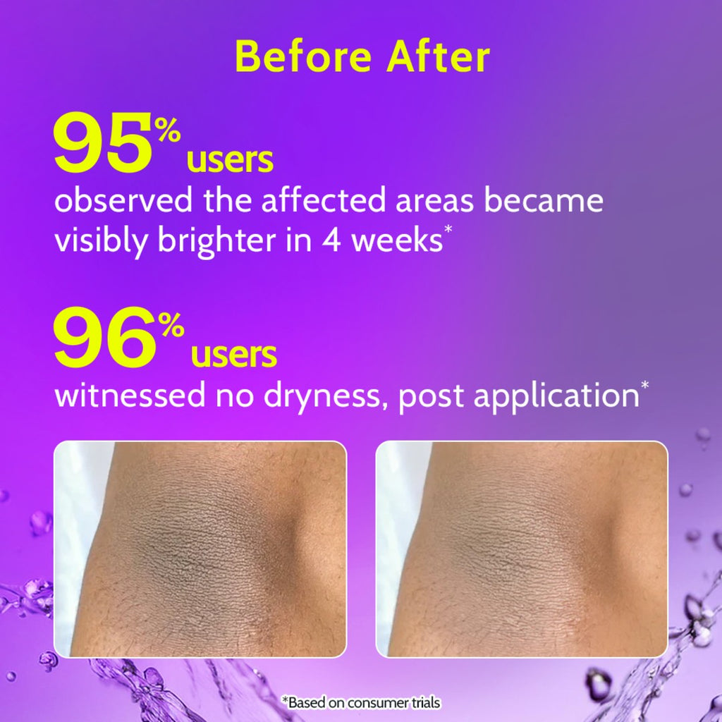 Chemist at Play Roll On Serum For Neck, Knee & Elbow With 6% Vitamin C+ Hyaluronic Acid + AHAs + Niacinamide + Ceramides | Exfoliates, Removes Pigmentation, and Hydrates Dry Skin | 1.4 fl oz.